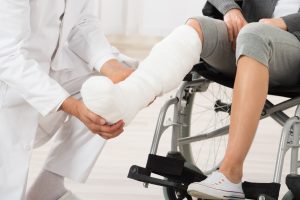 woman hurt leg doctor